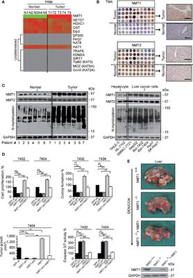 N-Myristoylation by NMT1 Is POTEE-Dependent to Stimulate Liver Tumorigenesis via Differentially Regulating Ubiquitination of Targets